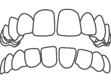 Graphic representing teeth