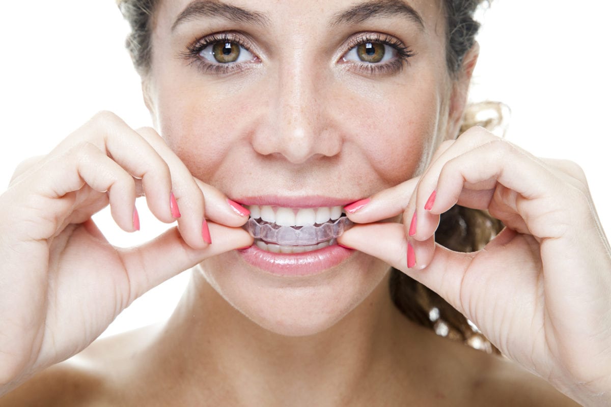 a woman putting Invisalignbraces in her mouth